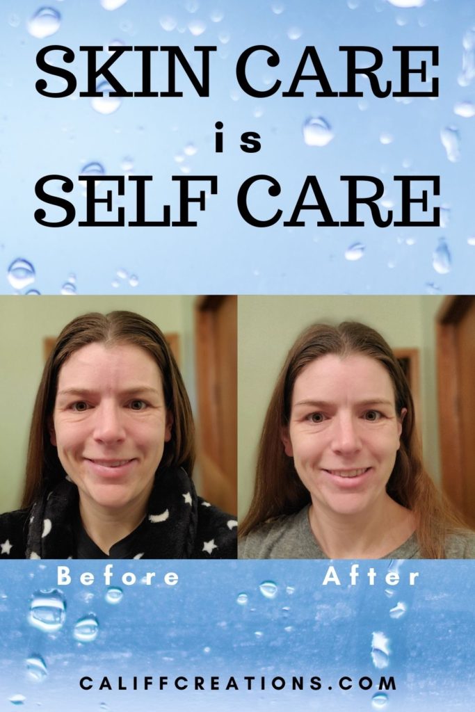 Skin Care is Self Care (before and after)